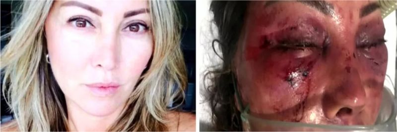 Elaine Perez Caparroz antes e depois das agressões