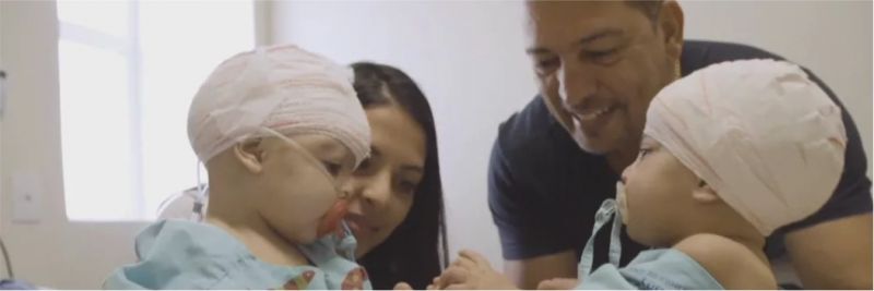 Gêmeas Lis e Mel se reencontram pela primeira vez depois de cirurgia inédita em Brasília — Foto: TV Globo/Reprodução